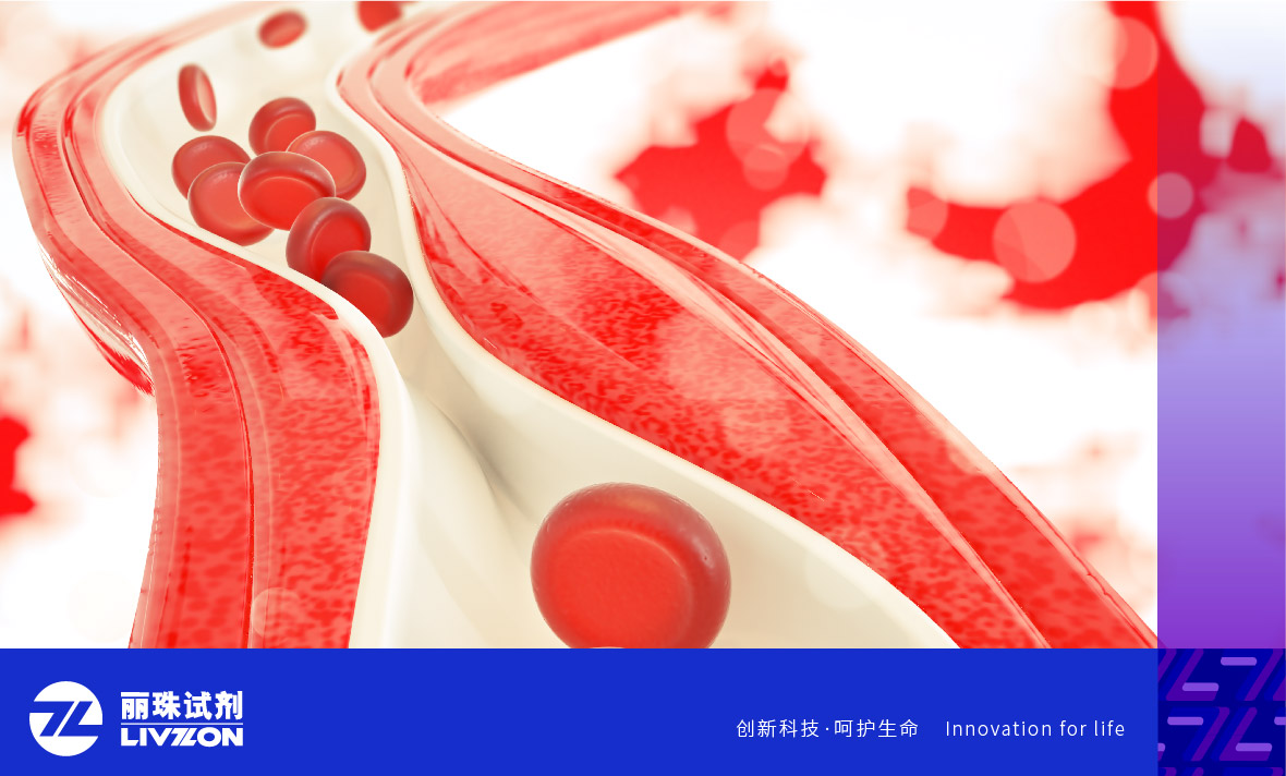 麗科普丨抗磷脂抗體陽(yáng)性能診斷為「 抗磷脂綜合征 」嗎？
